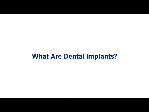 What Are Dental Implants? testimonial