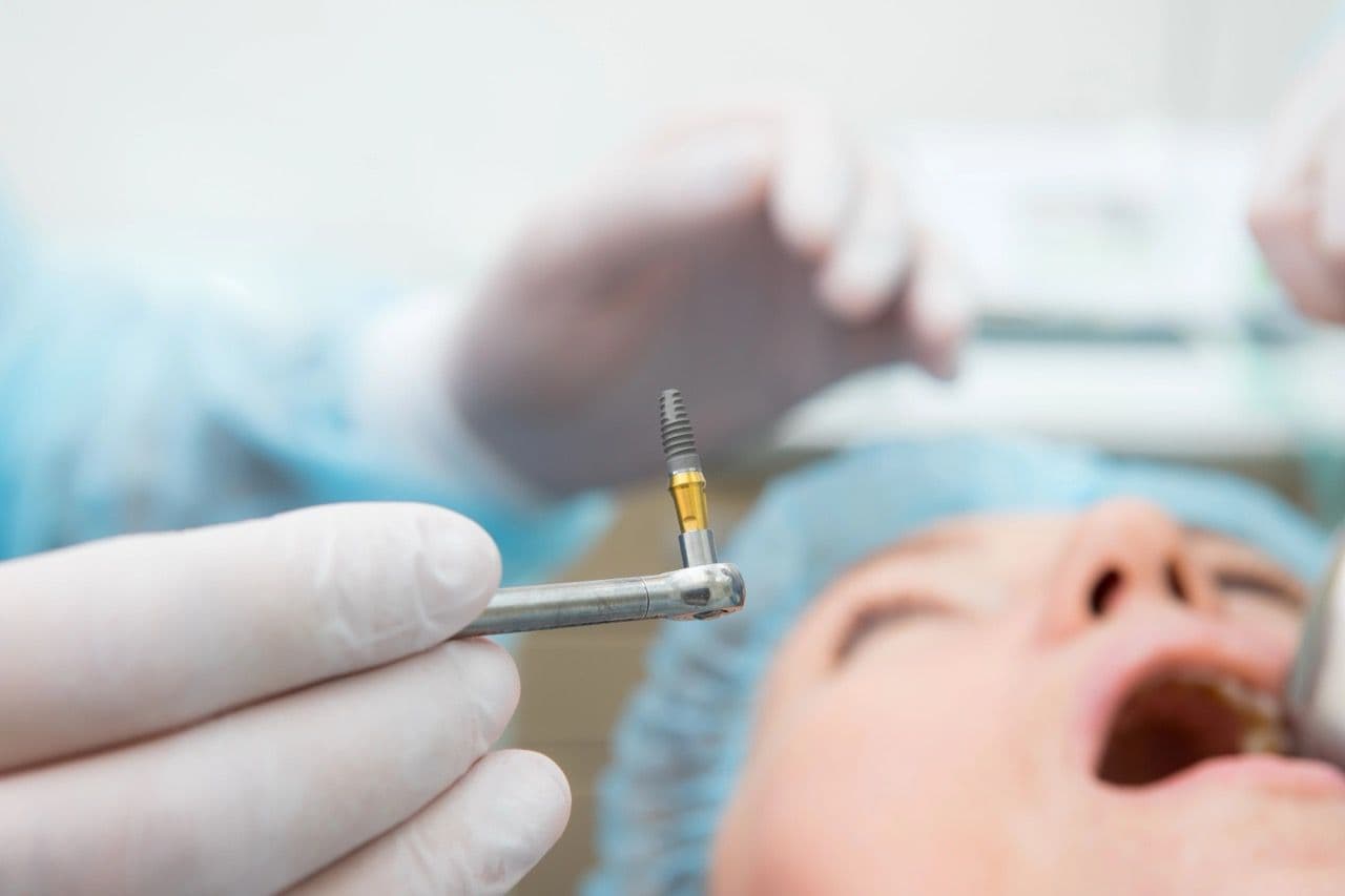 A photo of a dentist's hand with an implant on a tool and a patient waiting.