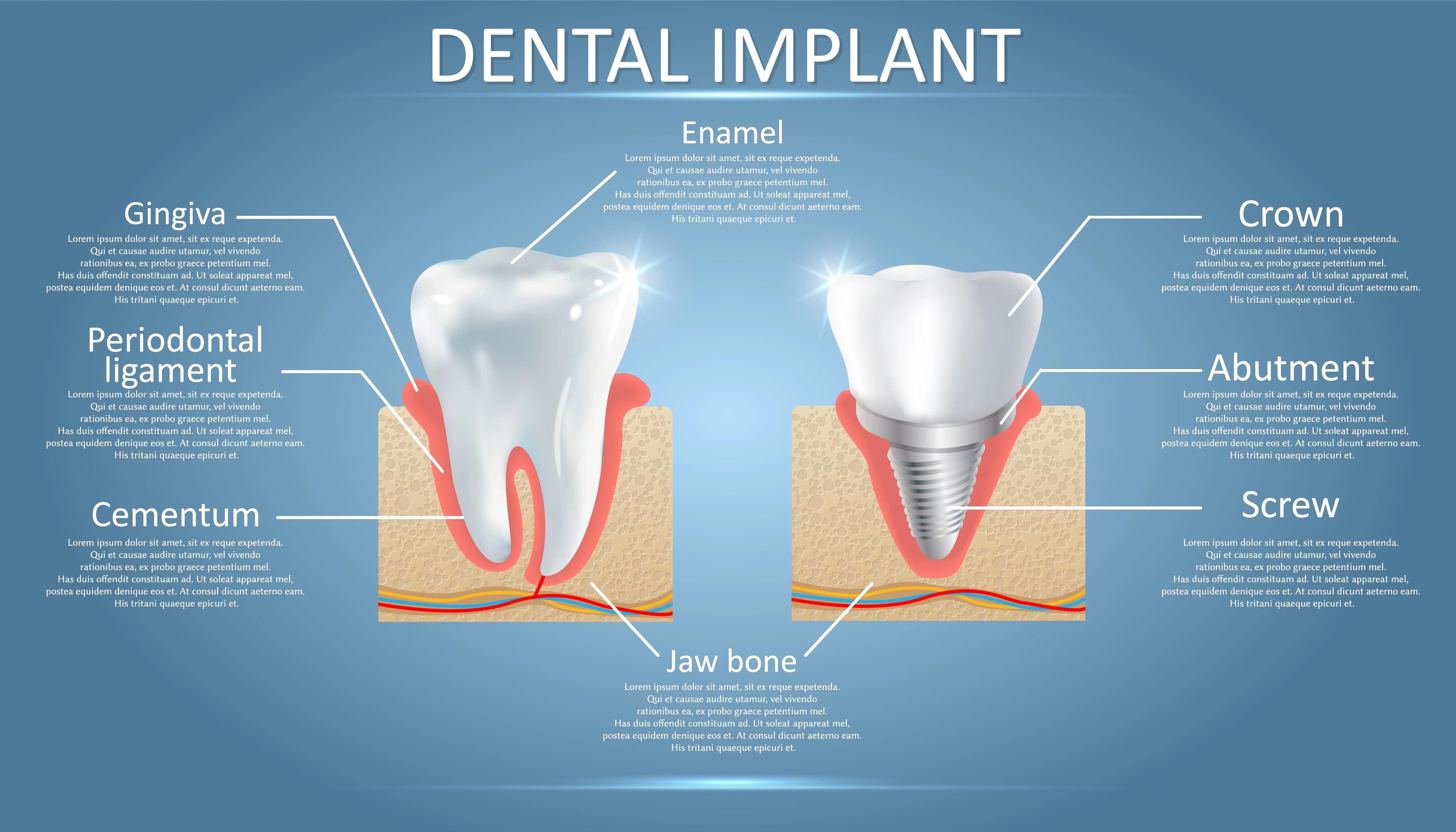 Infographic explaining the parts of a tooth.