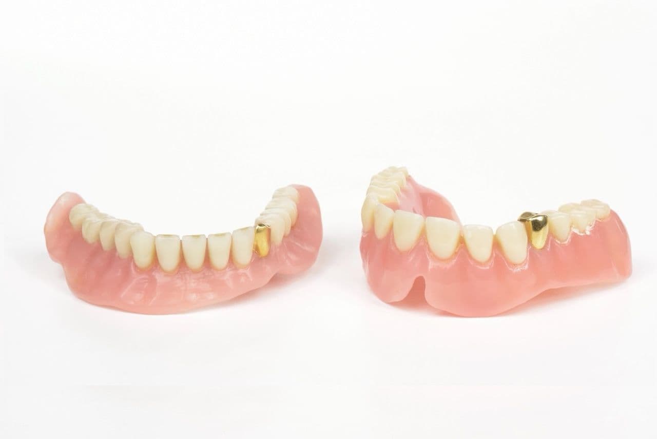 Photo of dentures with one gold tooth on each arch.